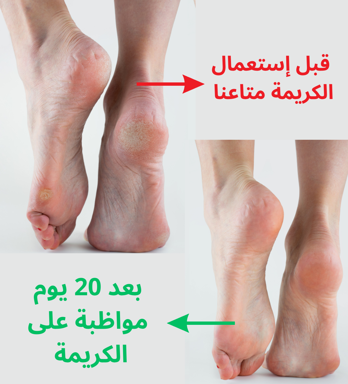 HYDRALIA Crème talon doux