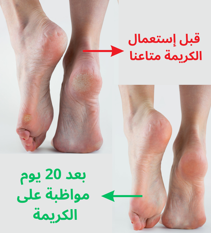 HYDRALIA Crème talon doux